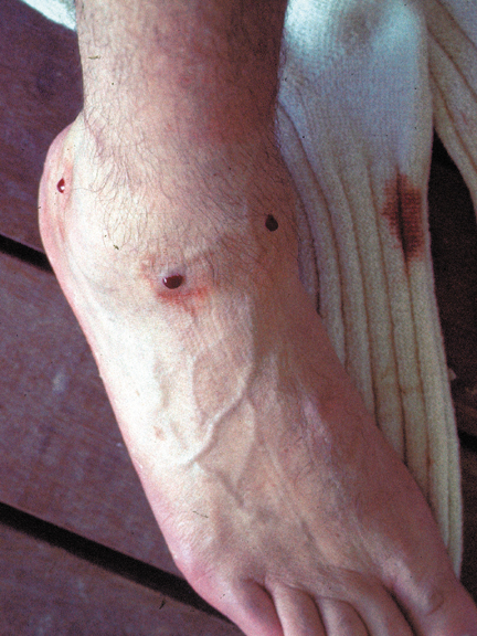 081A-Malay-leachfoot.