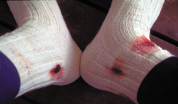 081B-Malay-leachsocks.